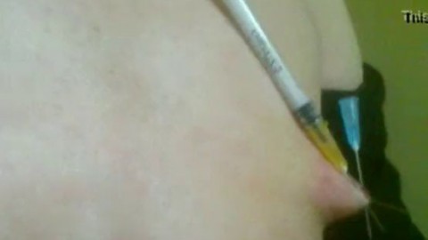 Needles in tits