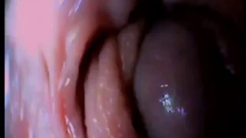 Recorded Cumshot By Webcam In Pussy (Doggy Fuck)